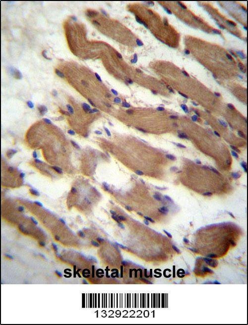 Anti-PALMD (N-term) Antibody