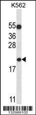 Anti-BAX (N-term) Antibody