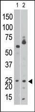 Anti-BNIP3 (BH3 Domain Specific) Antibody