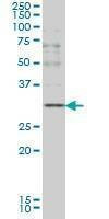 Anti-CD40LG Antibody