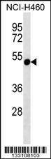Anti-RTDR1 (N-term) Antibody