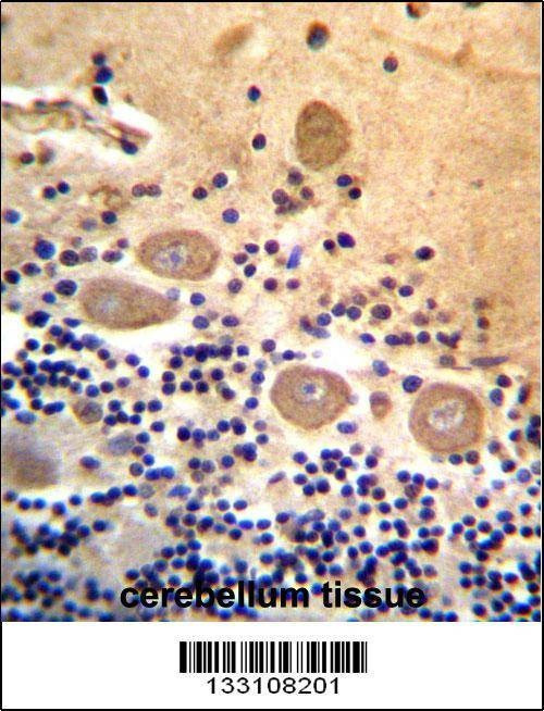 Anti-RTDR1 (N-term) Antibody