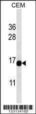 Anti-ATAD4 (C-term) Antibody