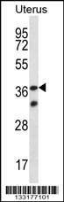 Anti-OR4X2 (C-term) Antibody
