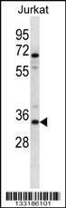 Anti-OR2G3 (C-term) Antibody