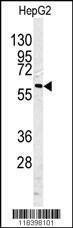 Anti-CASP10 (Center) Antibody
