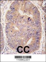 Anti-TASP1 (C-term) Antibody