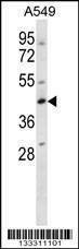 Anti-WDR45 (N-term) Antibody
