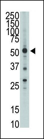 Anti-HtrA1 (N-term) Antibody