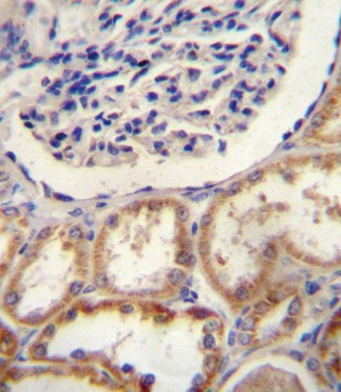 Anti-HtrA1 (N-term) Antibody