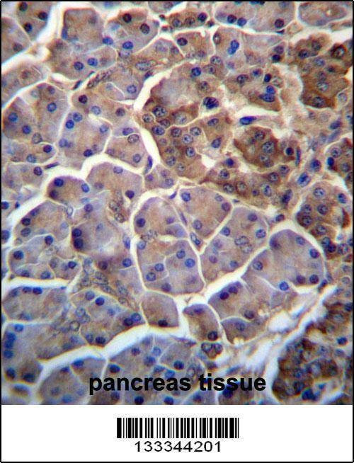 Anti-MOSPD2 (N-term ) Antibody