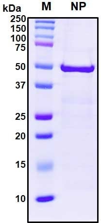 Recombinant SARS-CoV-2 Nucleocapsid Protein