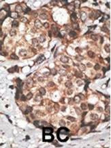Anti-HtrA3 (N-term) Antibody