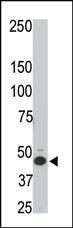 Anti-HtrA3 (N-term) Antibody