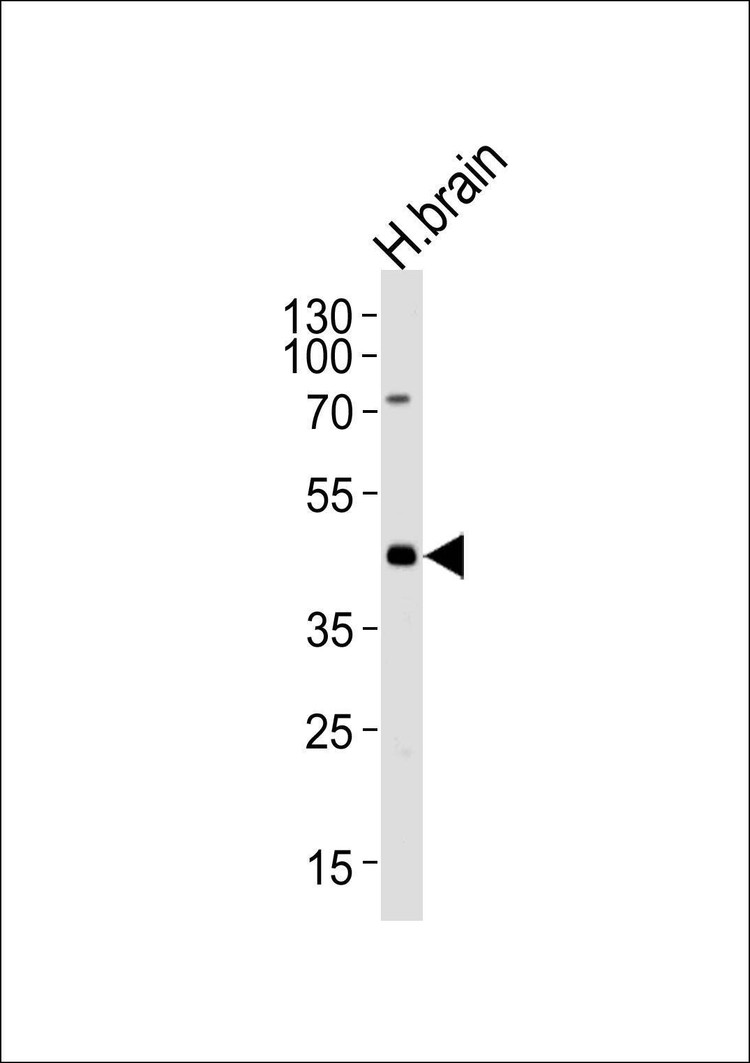 Anti-ELAVL3 (N-term) Antibody