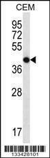Anti-OR7G2 (C-term) Antibody