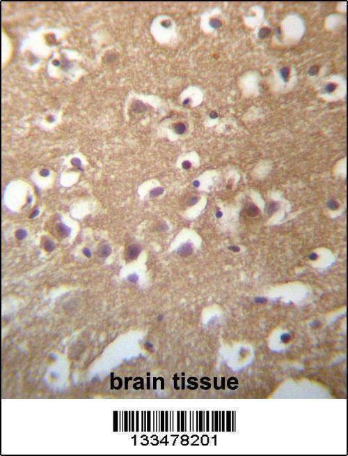 Anti-TMCC3 (Center) Antibody