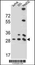 Anti-PGAM4 (N-term) Antibody