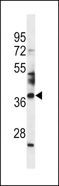 Anti-SPATA4 (Center) Antibody