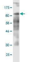 Anti-CD97 Antibody