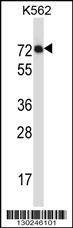 Anti-IL1RL2 (Center) Antibody
