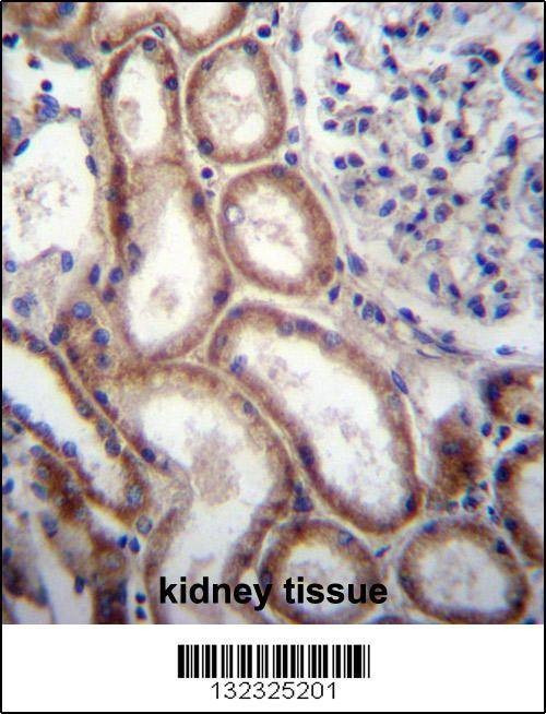 Anti-SLIT1 (N-term) Antibody