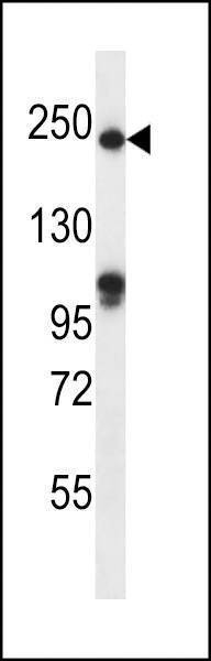 Anti-SLIT1 (N-term) Antibody