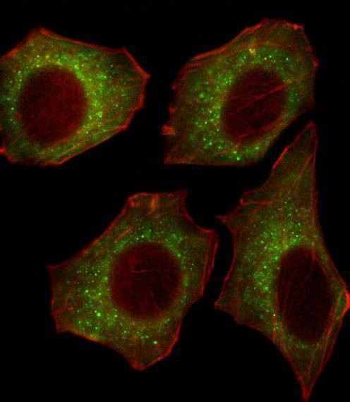 Anti-CACNA2D2 (Center) Antibody