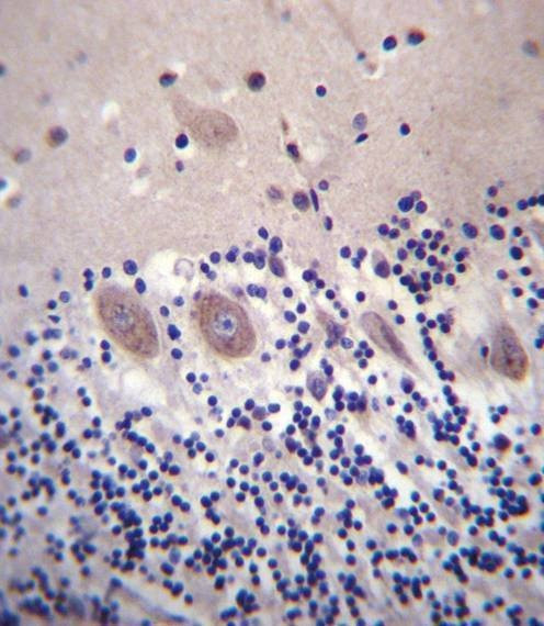 Anti-CACNA2D2 (Center) Antibody