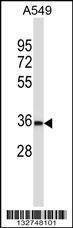 Anti-BEAN (N-term) Antibody