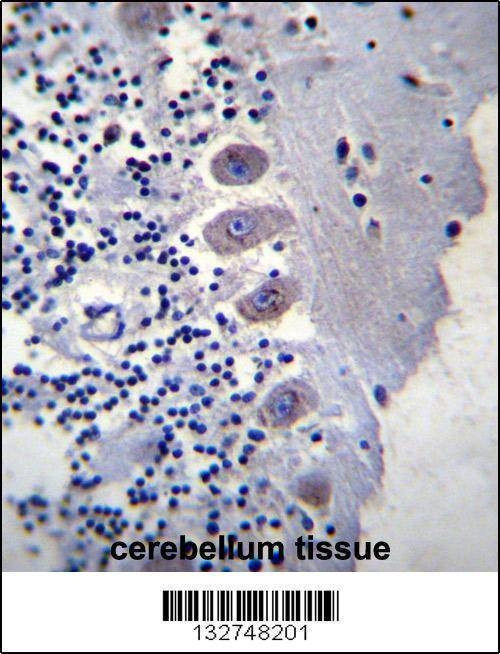 Anti-BEAN (N-term) Antibody