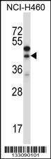 Anti-CTGF (Center) Antibody