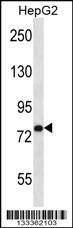 Anti-USP45 (Center) Antibody