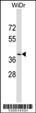 Anti-DUOXA2 (C-term) Antibody