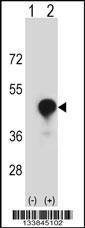 Anti-CD1C (C-term) Antibody