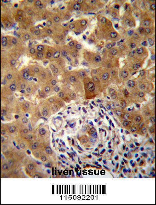 Anti-PHF17 (N-term) Antibody