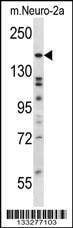 Anti-ATG2B (N-term) Antibody