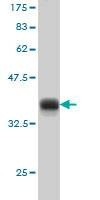 Anti-CDC25A Antibody