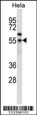 Anti-FOXN4 (N-term) Antibody