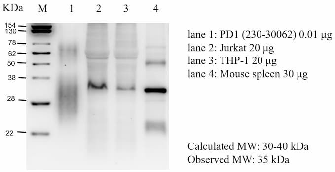 Anti-PD-1 Antibody