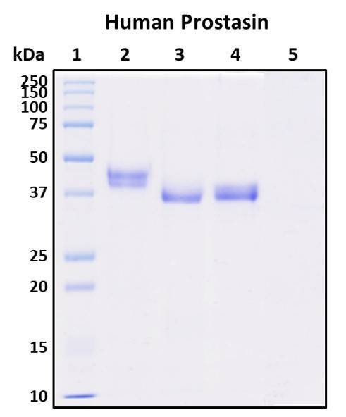 Recombinant Human Prostasin Protein, HEK293