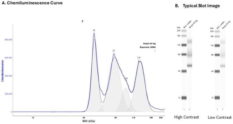 Recombinant protein: Serpin A3 Ag (Cat. #: 230-31020) | Secondary Ab: Rabbit | Exposure: HDR4 | Expected MW (kDa): 48