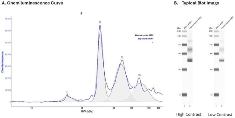 Human serum 20X | Secondary Ab: Rabbit | Exposure: HDR4 | Expected MW (kDa): 48