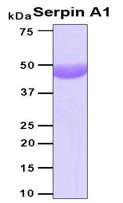 Recombinant Human Serpin A1 Protein
