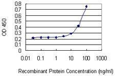 Anti-CDC2L6 Antibody