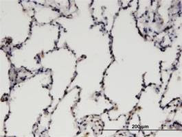 Anti-CDC2L6 Antibody