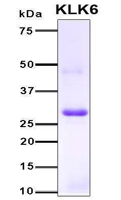 Recombinant Human KLK6 Protein