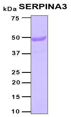 Recombinant Human AACT (SERPINA3) Protein