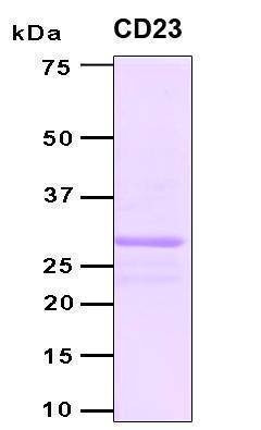 Recombinant Human Fc-epsilon RII (CD23) Protein