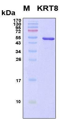 Recombinant Human KRT8 Protein